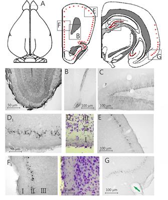 Widespread Doublecortin Expression in the Cerebral Cortex of the Octodon degus